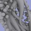 Staphylococcus (MRSA)