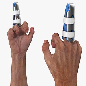Finger Support Splint on Raised Middle Finger