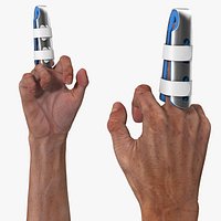 Finger Support Splint on Raised Middle Finger