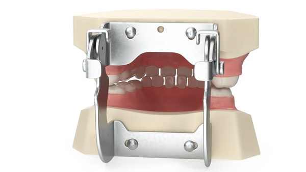 이동식 치아가 있는 치과 해부학 소아 Typodont 모델 3D 모델 - TurboSquid 2052620