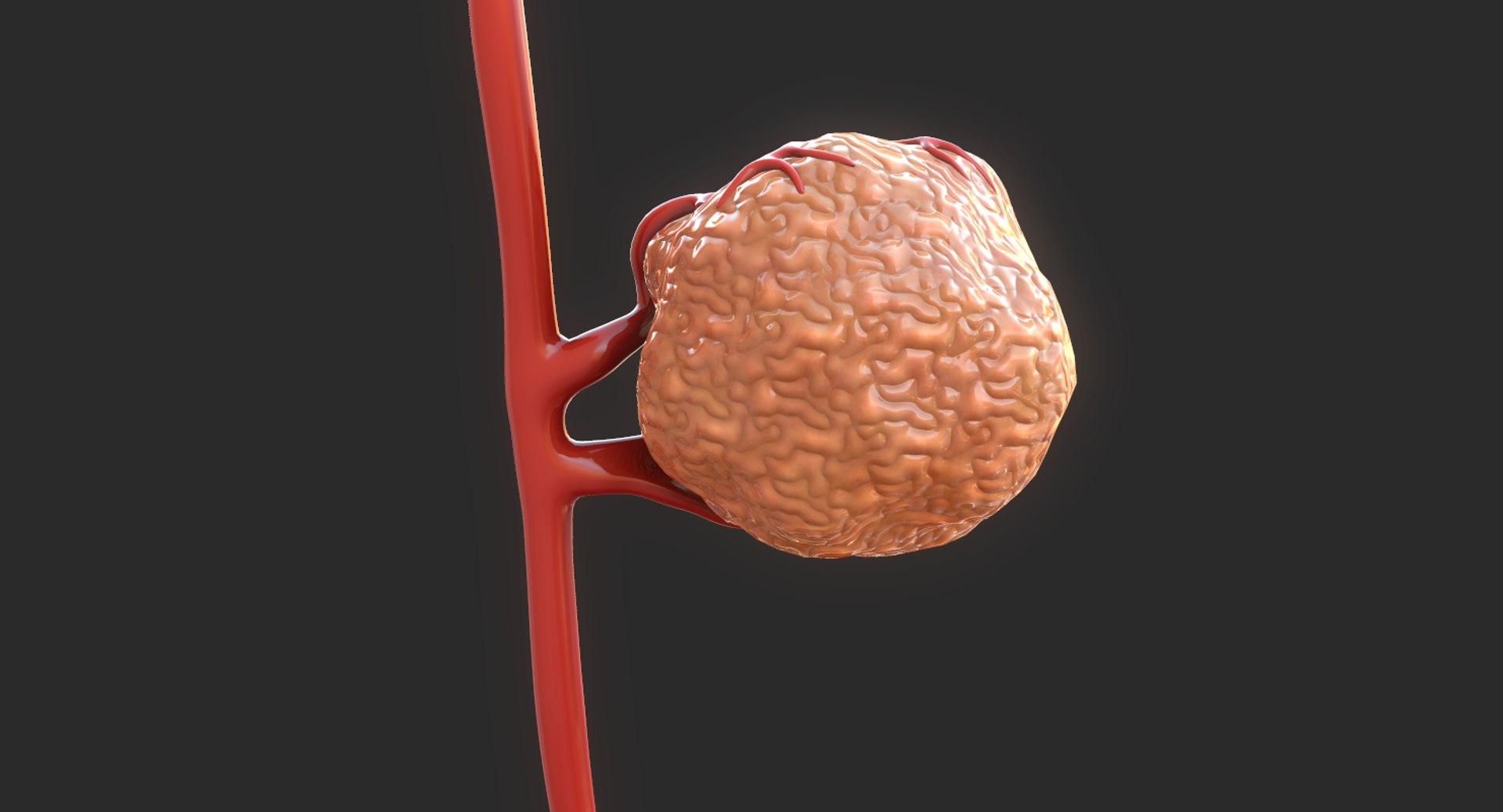3D model tumor vessels https://p.turbosquid.com/ts-thumb/UR/s774mi/5ltyOhfH/14/png/1562676773/1920x1080/fit_q87/ff4522fc816740cab755ec7d630475f77d1dd851/14.jpg