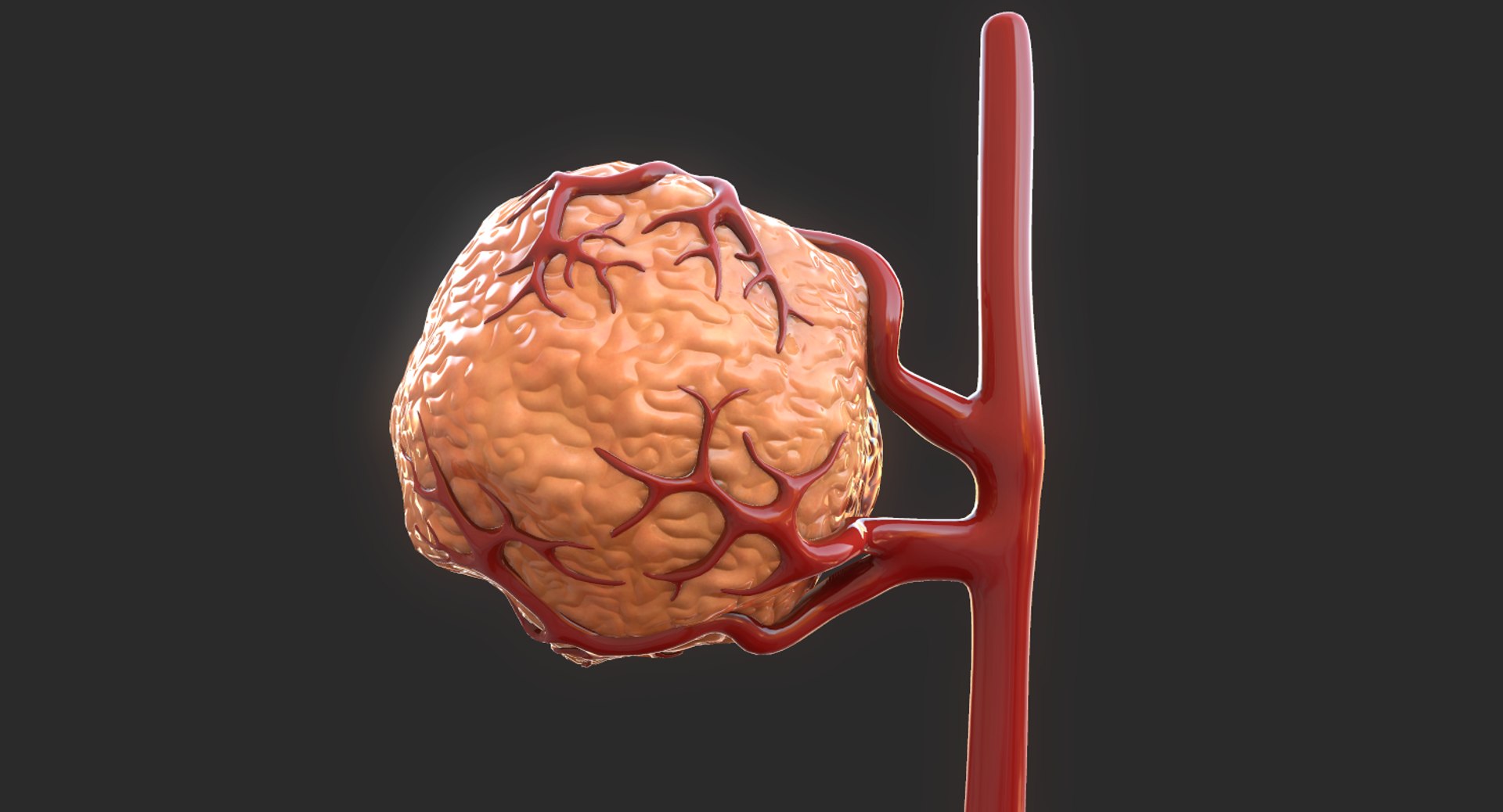 3D model tumor vessels https://p.turbosquid.com/ts-thumb/UR/s774mi/G9Sauiho/10/png/1562676773/1920x1080/fit_q87/e67f1512e9f8bc4b5185a413a7444b950f90c467/10.jpg