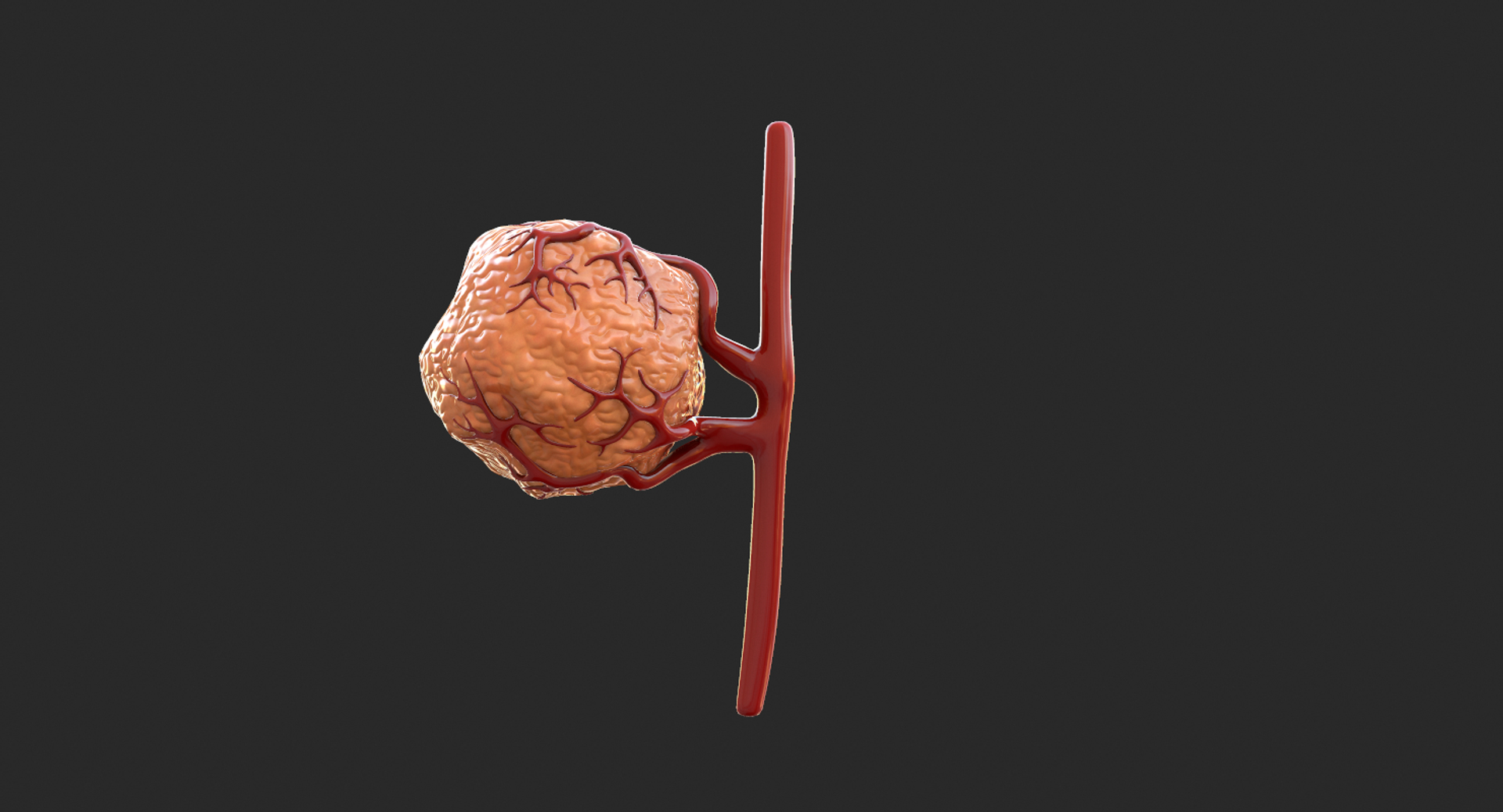 3D model tumor vessels https://p.turbosquid.com/ts-thumb/UR/s774mi/PefkDgW8/1/png/1562676802/1920x1080/turn_fit_q99/9076e1d26c47becb144716a7066977f18d360594/1-1.jpg