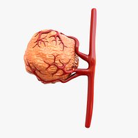 Tumor with Vessels