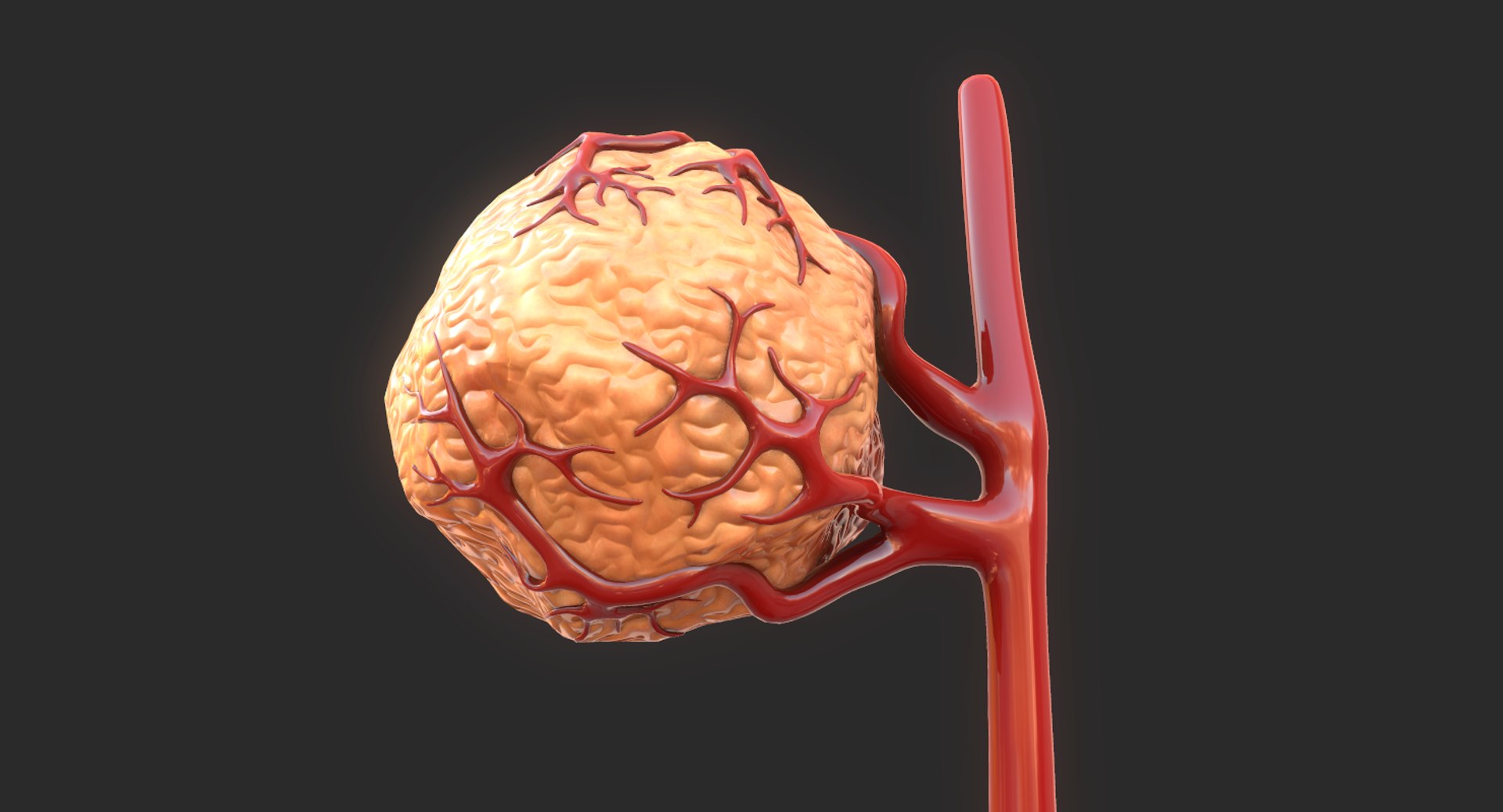3D model tumor vessels https://p.turbosquid.com/ts-thumb/UR/s774mi/RrNA6stu/12/png/1562676773/1920x1080/fit_q87/6d43359830300f3f246e6266cc089a1f105395cf/12.jpg