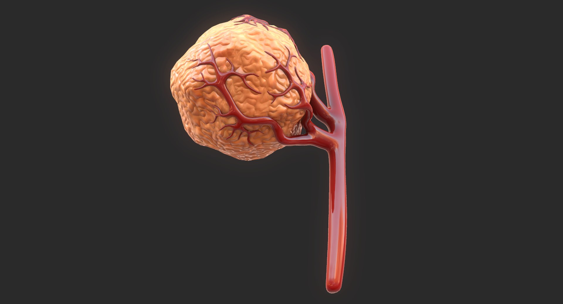 3D model tumor vessels https://p.turbosquid.com/ts-thumb/UR/s774mi/TF0Kftje/6/png/1562676773/1920x1080/fit_q87/1bfe0e6968bd258a88b9e6d645dc9567269f05b8/6.jpg
