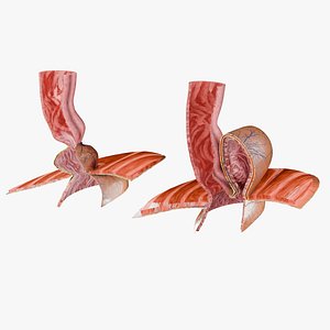 3D Hiatal hernia stomach sliding paraesophageal model