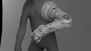 prosthetic arm 3D