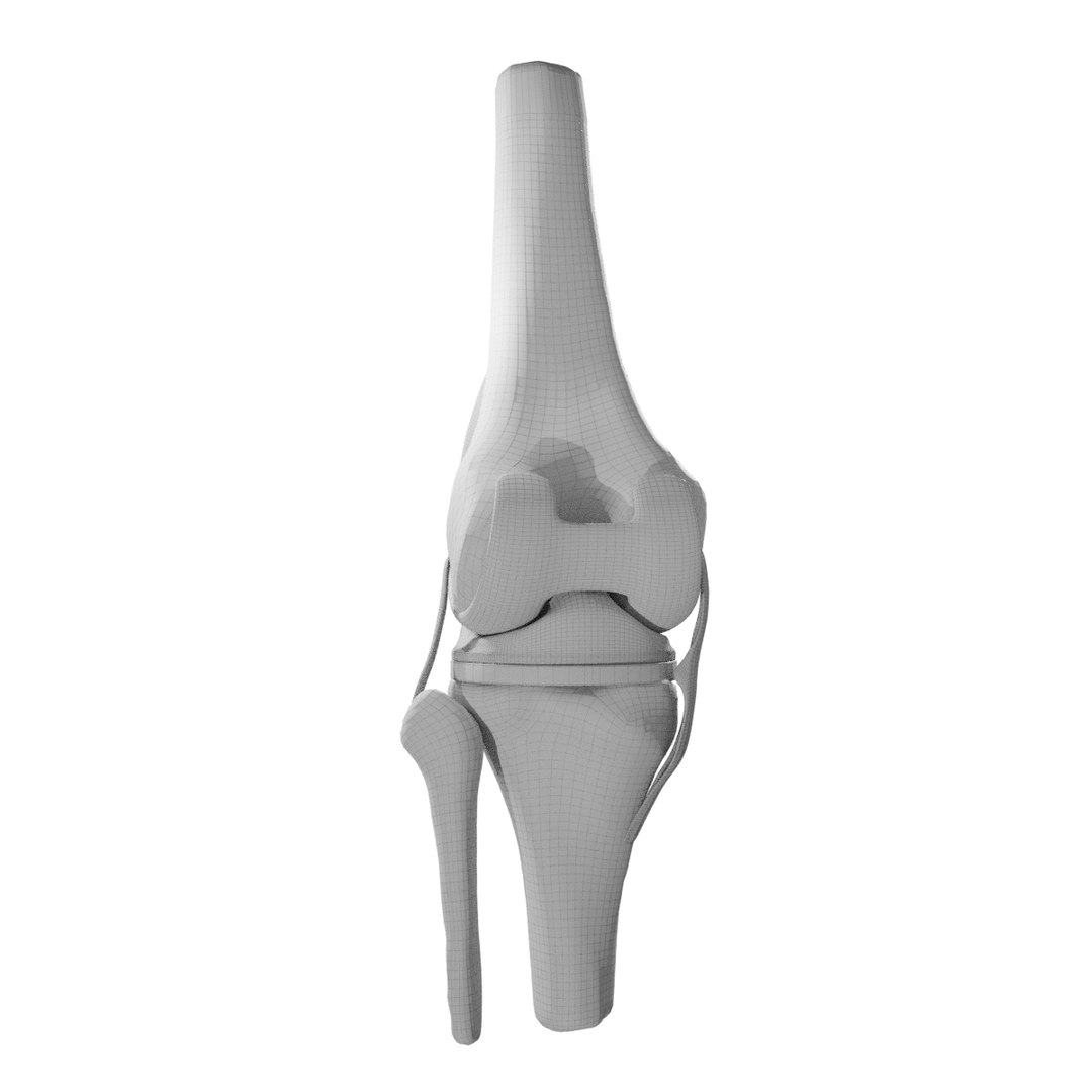 3D knee replacement model https://p.turbosquid.com/ts-thumb/UZ/ReHUao/j3VUykvx/wire3/jpg/1586021010/1920x1080/fit_q87/7bf8c8d799917a9145a9690eb40e4ee9bad96653/wire3.jpg