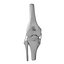 Knee replacement