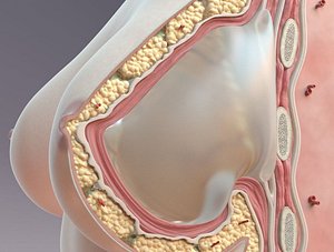Breast Cross Section Implant