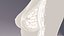 乳房断面インプラント