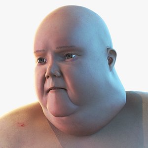 Obese Person