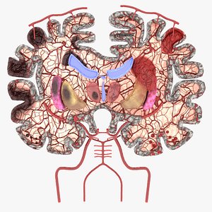 Stroke brain infarct hemorrhage types