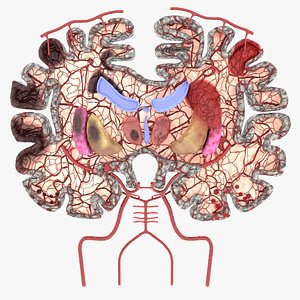 Stroke brain infarct hemorrhage types