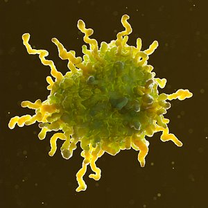Cancer cell
