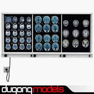 X Ray Light Box
