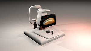 3D Gonioscope