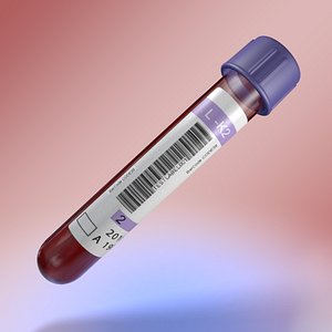 Medical test tube with blood