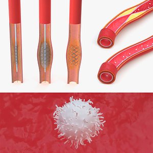 Arteries in Cross Section Collection model