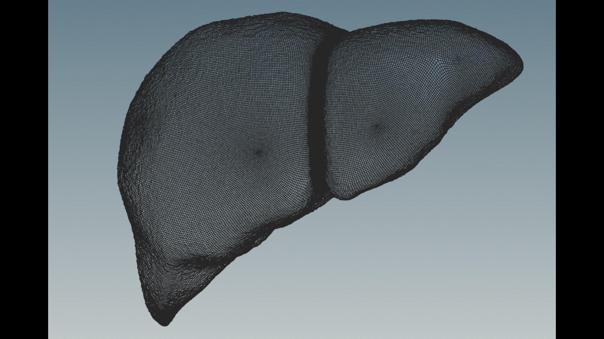 3D model Hepatitis  liver disease digestive system organs https://p.turbosquid.com/ts-thumb/VB/z6bJpM/SA/1/png/1770443198/1920x1080/fit_q87/136f79e90851a53857f757dc3e900fb62566dd8c/1.jpg