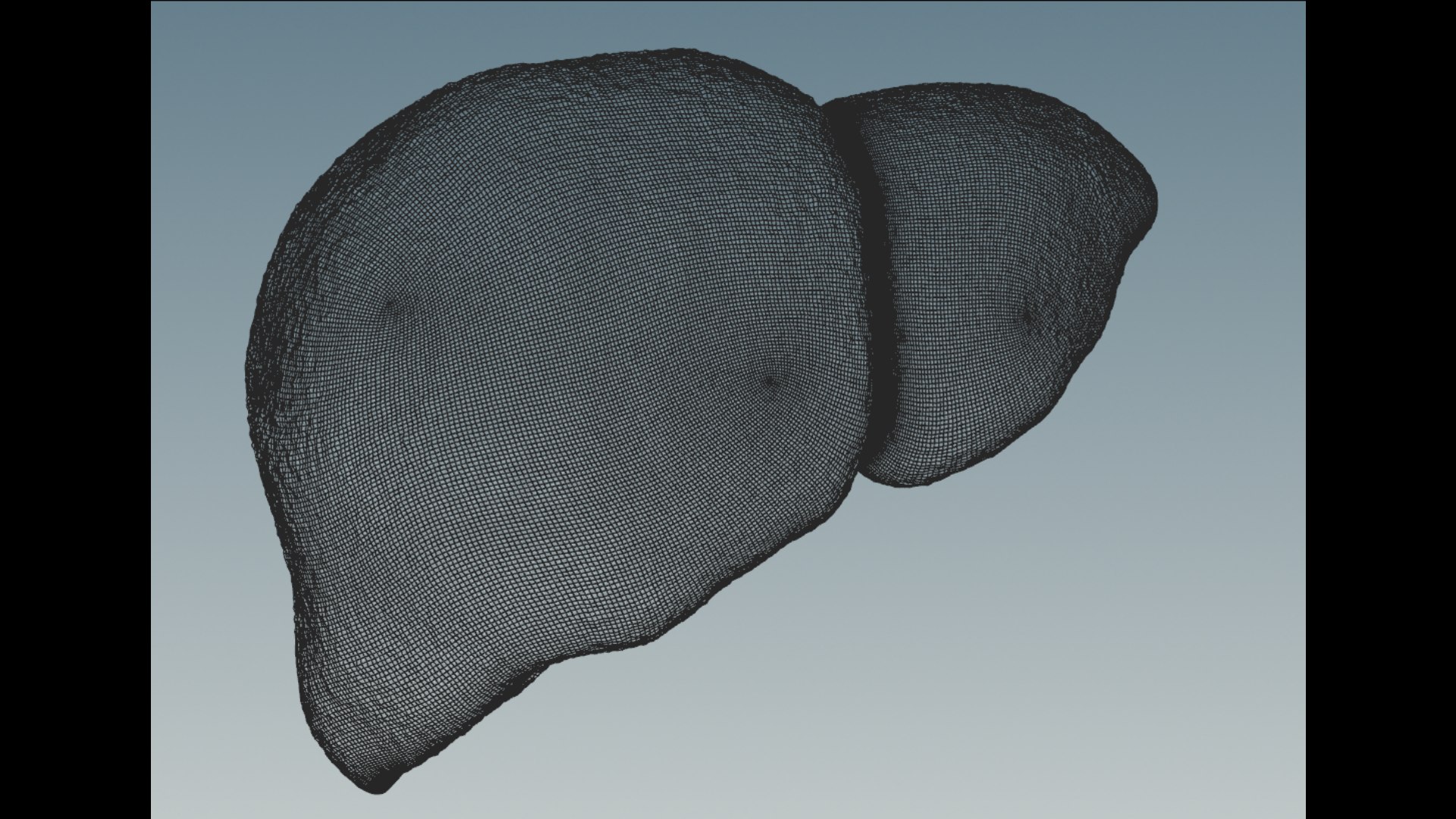 3D model Hepatitis  liver disease digestive system organs https://p.turbosquid.com/ts-thumb/VB/z6bJpM/ek/3/png/1770443205/1920x1080/fit_q87/0d7e5a0fe962e64ef456ff193f71e7c95ea22703/3.jpg