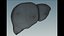 Hepatitis  liver disease digestive system organs