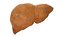 Hepatitis  liver disease digestive system organs