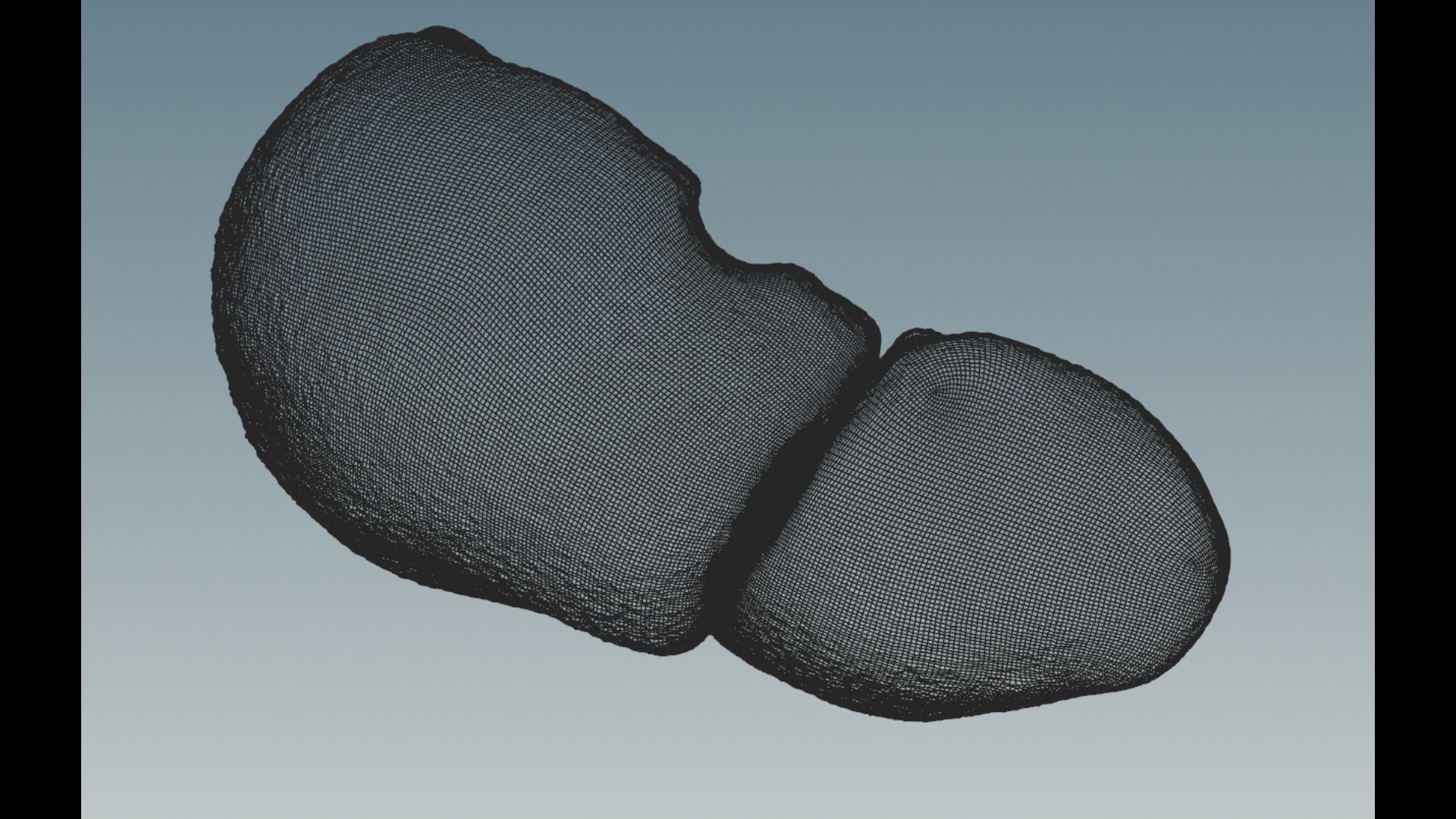 3D model Hepatitis  liver disease digestive system organs https://p.turbosquid.com/ts-thumb/VB/z6bJpM/kc/2/png/1770443203/1920x1080/fit_q87/fe7573e2f220d124d9a5c2b703a48bcca7bb167c/2.jpg