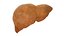 Hepatitis  liver disease digestive system organs