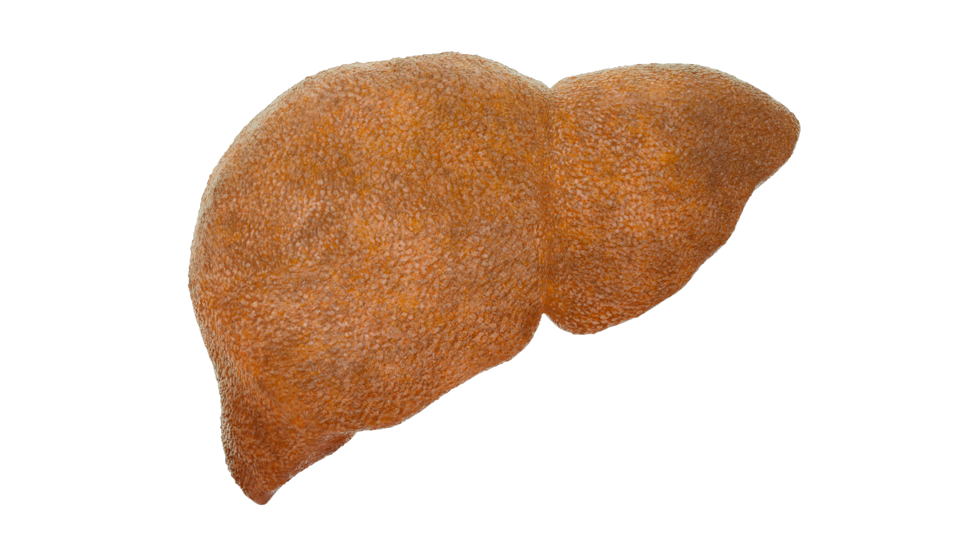 3D model Hepatitis  liver disease digestive system organs https://p.turbosquid.com/ts-thumb/VB/z6bJpM/tx/b/png/1770443279/1920x1080/turn_fit_q99/8bbdb42e8b3d6ac91bd195bed77952658cd88119/b-1.jpg