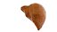 Hepatitis  liver disease digestive system organs
