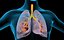 Lungs X-Ray