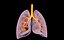 Lungs X-Ray