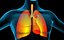 Lungs X-Ray