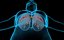 Lungs X-Ray
