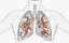 Lungs X-Ray