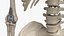 Squelette masculin avec implants articulaires en ivoire