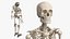Squelette masculin avec implants articulaires en ivoire