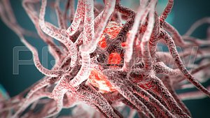 Cancer Static Hipoly Model