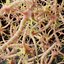 Anatomie des cellules nerveuses des neurones en détails