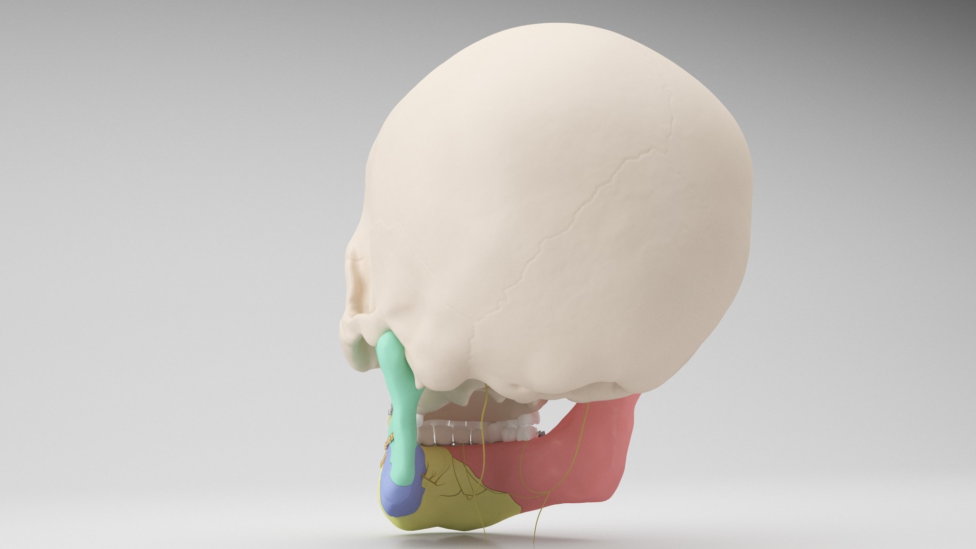 Male Skull - Mandible fracture 3D model https://p.turbosquid.com/ts-thumb/W6/IoJ3xH/tj/mandiblefracture06/jpg/1726988318/1920x1080/fit_q87/09ef64e7d9783b460d03c6b209e2205c2717e614/mandiblefracture06.jpg