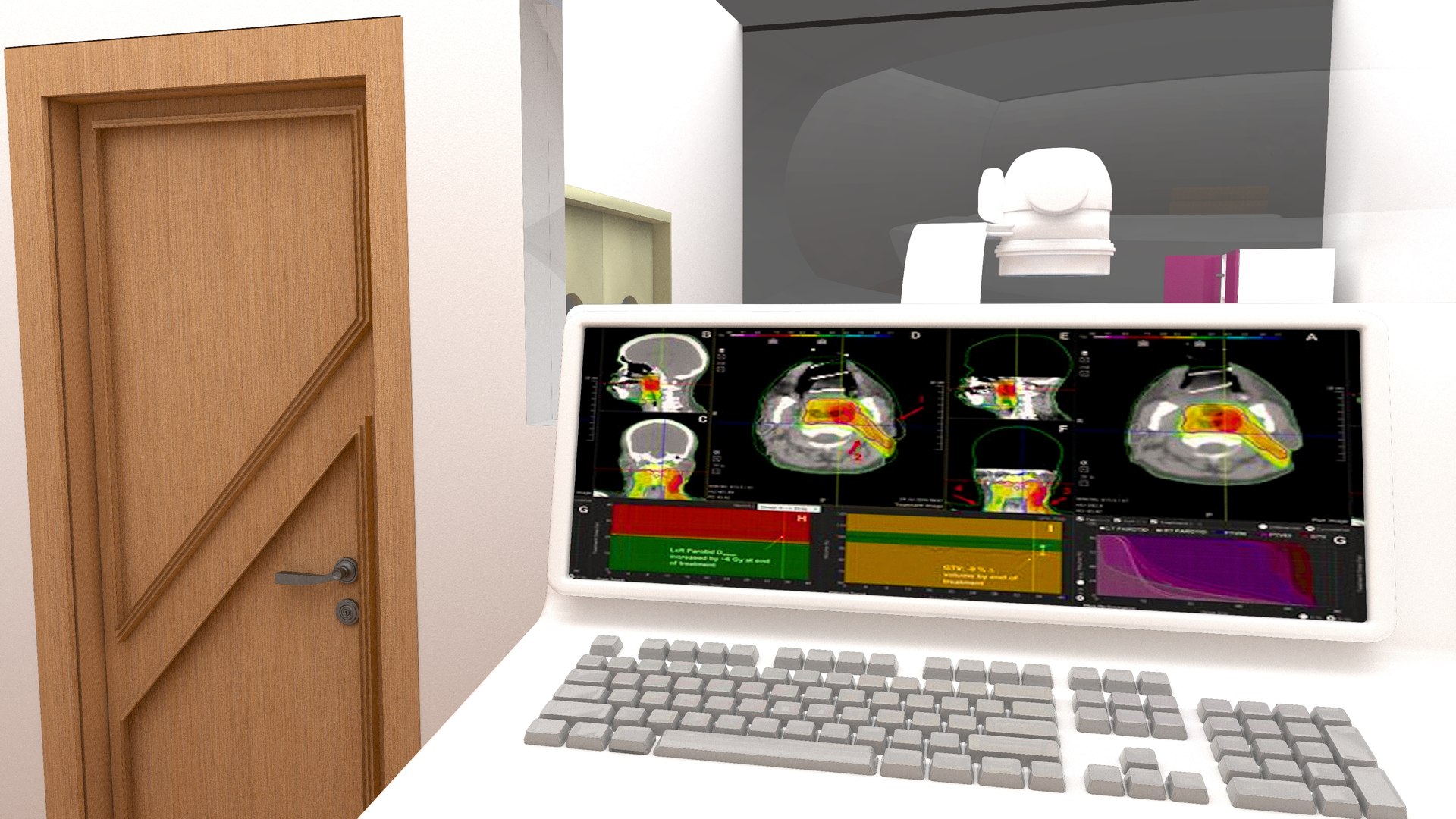 3D Radiotherapy Unit - TurboSquid 2060687