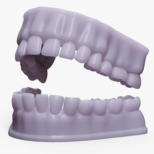 Dentures D Mold