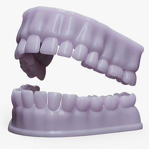 Dentures D Mold