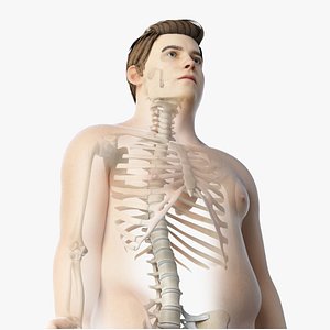 3D model skin obese male skeleton