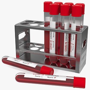 Test Tube Rack with Mixed Covid 19 Tests