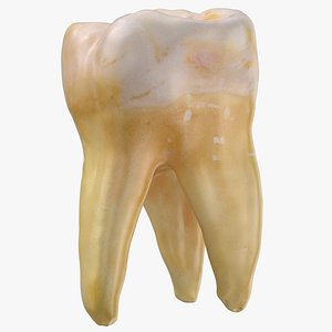 Molar Upper Jaw Right 03