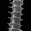 3D Cervical Spine Vertebrae model