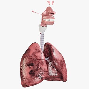 Respiratory System Smoker's Lungs light stage